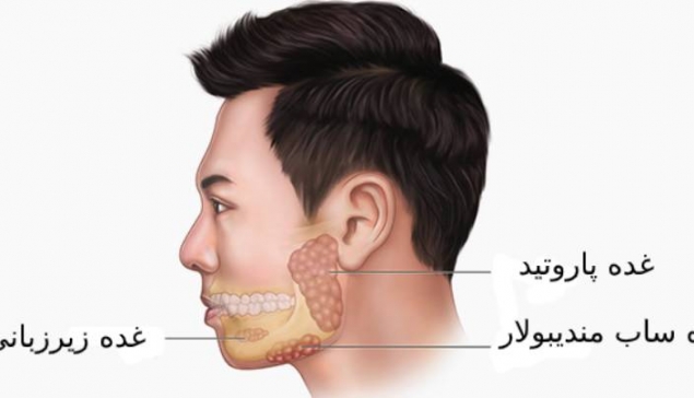 پاراتیدیت